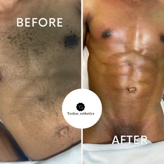 Before and after of a body waxing service